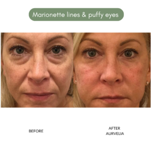 Aurvelia Multi Active Serum 2.0