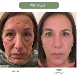 Aurvelia Multi Active Serum 2.0