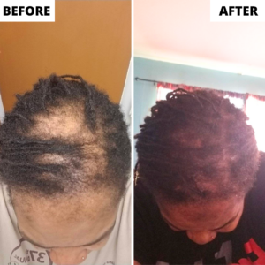 Rennora Beauty Hair Growth Serum