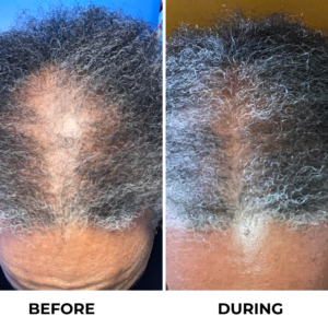 Rennora Beauty Hair Growth Serum