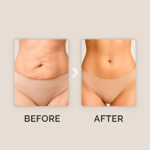 SKINCU Glow Remedy Oil