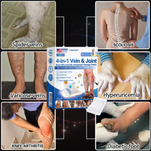 Healrize® 4-in-1 Vein & Joint Nano Microneedle Advanced Therapy Patch