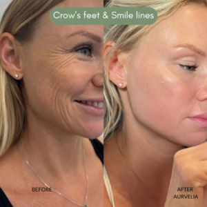 Aurvelia Multi Active Serum 2.0