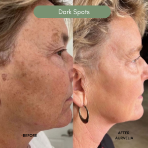 Aurvelia Multi Active Serum 2.0