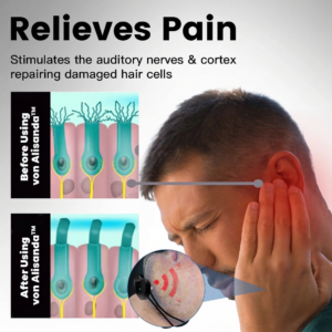 Alisanda®Tinnitus Relieving Device