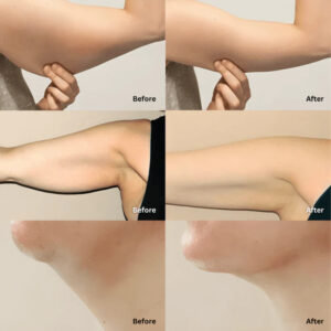 Fosters Organic Lymphatic Support Herbal Blend