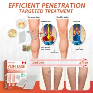 Zvoevo® Vein Ease Microneedle Care Patch