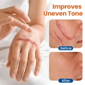 Timilk® DermalRebuild Skin Renewal Gel