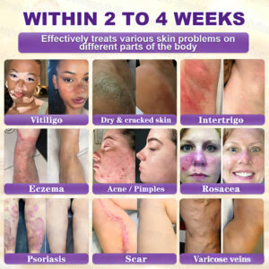 Evolvion® Biotin 10-in-1 Skin Restoration Cream