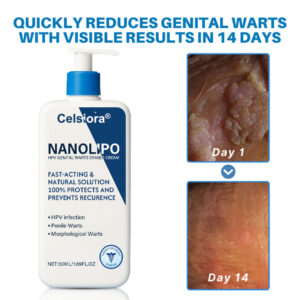 Celsiora® NanoLipo HPV Genital Warts Eraser Cream Plus+