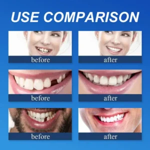 Yagoo® Custom-Fit Full Functional Dentures Make you more confident