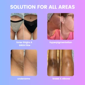 Velura Underarm Brightening Deodorant Cream