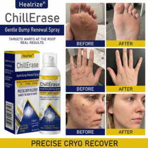 Healrize®ChillErase Gentle Bump Renewal Spray