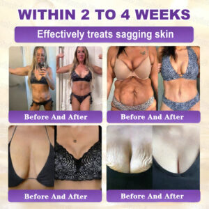 Evolvion® Biotin 10-in-1 Skin Restoration Cream