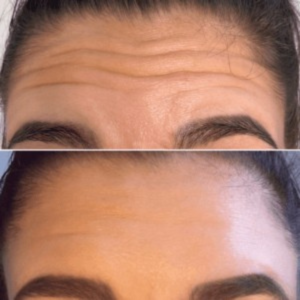 YUNPSO™ Collagen Oil | Tightens and lifts sagging skin by 98% within 24 hours