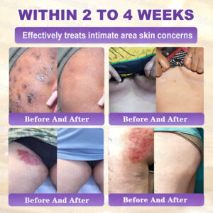 Evolvion® Biotin 10-in-1 Skin Restoration Cream