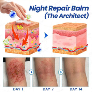 KUBOZN® Psoriasis Day & Night Repair System