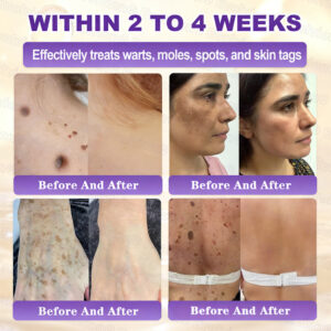 Evolvion® Biotin 10-in-1 Skin Restoration Cream