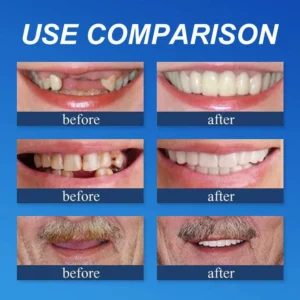 Yagoo® Custom-Fit Full Functional Dentures Make you more confident