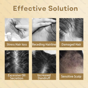 Healrize® Hair Regrowth Capsules, Newly Upgraded,Nano Penetration, Deep into Hair Roots
