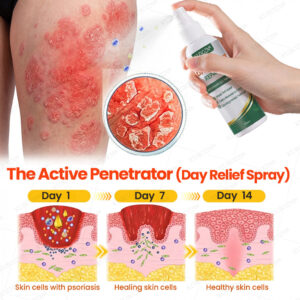 KUBOZN® Psoriasis Day & Night Repair System