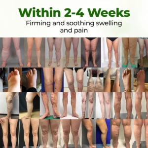 Healrize® Professional Leg Circulation Cream