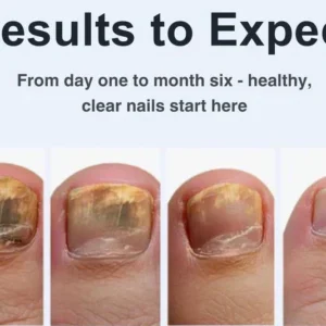 SEAGRIL-Nail Recovery Essence Pen