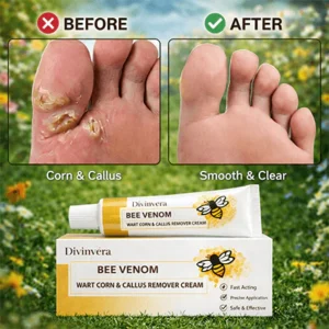 Divinvéra Bee Venom Wart Corn & Callus Remover Cream