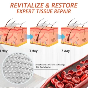 Zvoevo® Vein Ease Microneedle Care Patch