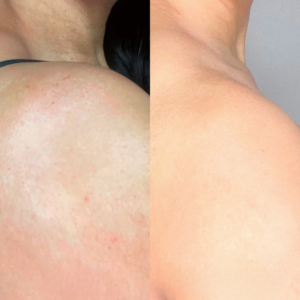 YUNPSO™ Collagen Oil | Tightens and lifts sagging skin by 98% within 24 hours