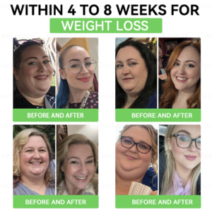 Geelemon NMN Berberine AMPK Advanced Nano Microneedle Patch