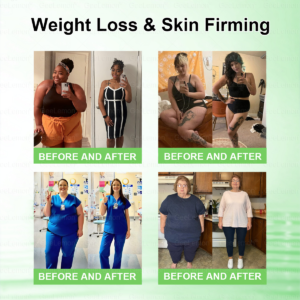 Geelemon NMN Berberine AMPK Advanced Nano Microneedle Patch