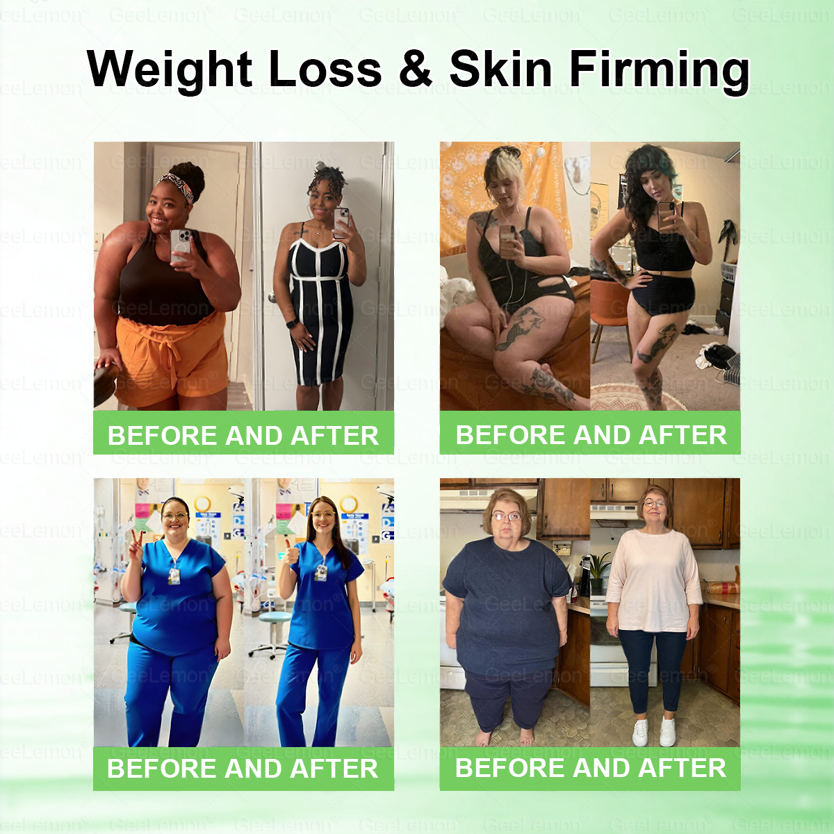 Geelemon NMN Berberine AMPK Advanced Nano Microneedle Patch