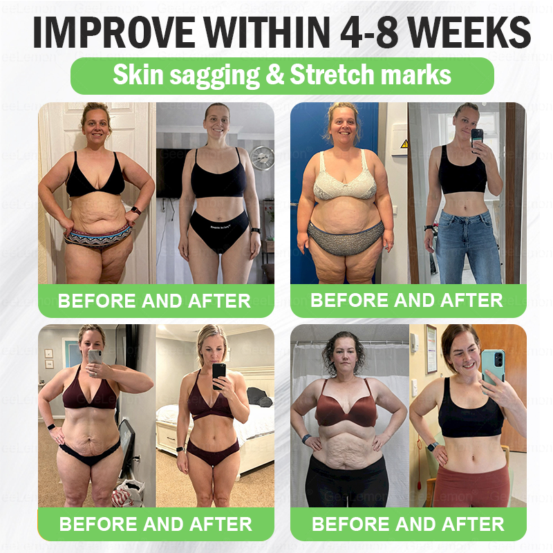 Geelemon NMN Berberine AMPK Advanced Nano Microneedle Patch