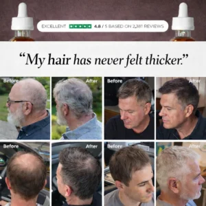 Keapers FST-5 Peptide Complex Hair Regrowth Solution