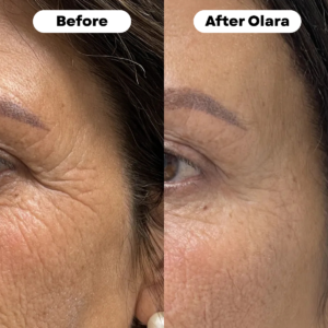 Olara™ Nicotinamide Riboside + Resveratrol