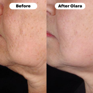 Olara™ Nicotinamide Riboside + Resveratrol