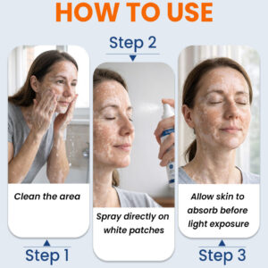 KUBOZN® Piperine Repigment Activator Spray