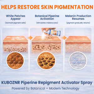 KUBOZN® Piperine Repigment Activator Spray
