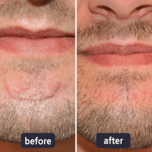 LBMLBM® Advanced Scar Repair and Skin Renew Cream