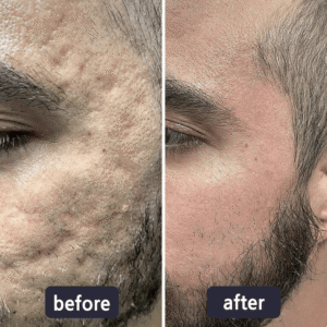 LBMLBM® Advanced Scar Repair and Skin Renew Cream