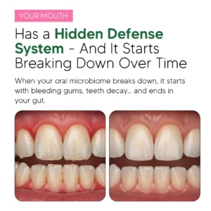 Oracare Oral Defence – Maximum Potency Oral Microbiome Restoration