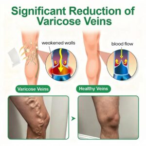 Healrize® VeinEase Microneedle Care Patch