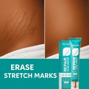 BQYOOM Repair Scar Cream - Fade old scars, stretch marks & burns naturally