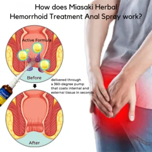 Miasaki Fast Herbal Hemorrhoid Spray