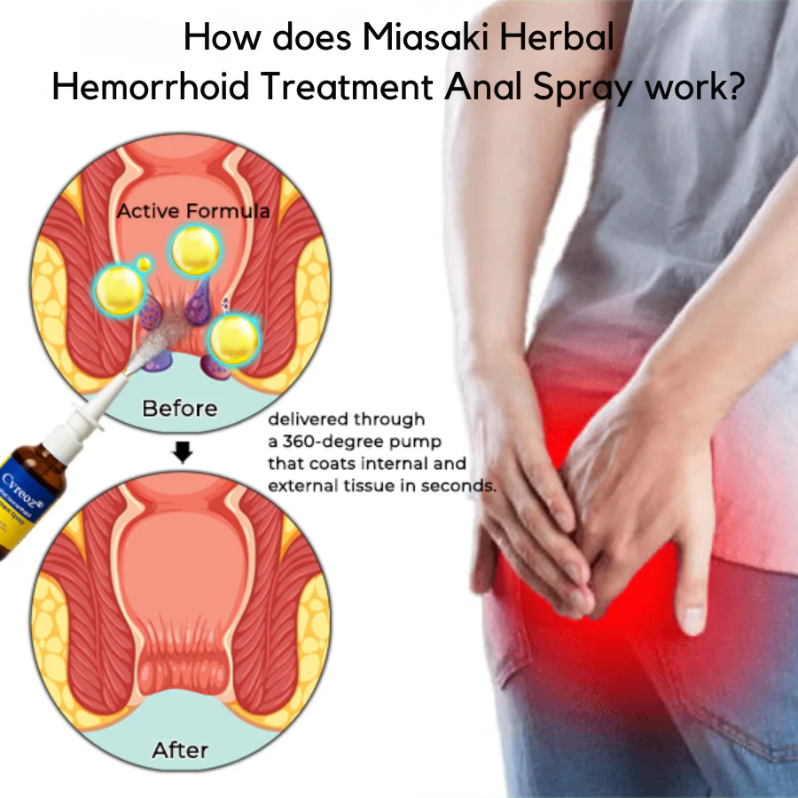 Miasaki Fast Herbal Hemorrhoid Spray - Image 2