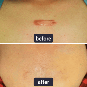 LBMLBM® Advanced Scar Repair and Skin Renew Cream