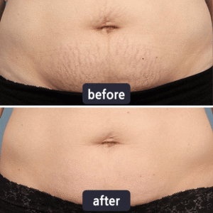 LBMLBM® Advanced Scar Repair and Skin Renew Cream