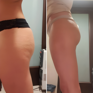 YUNPSO™ Collagen Oil | Tightens and lifts sagging skin by 98% within 24 hours