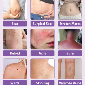 Luxevéria Microneedle Stretch Mark Patch